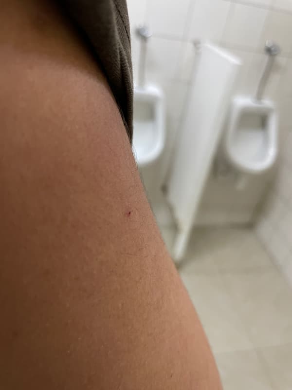 Vaccination mark